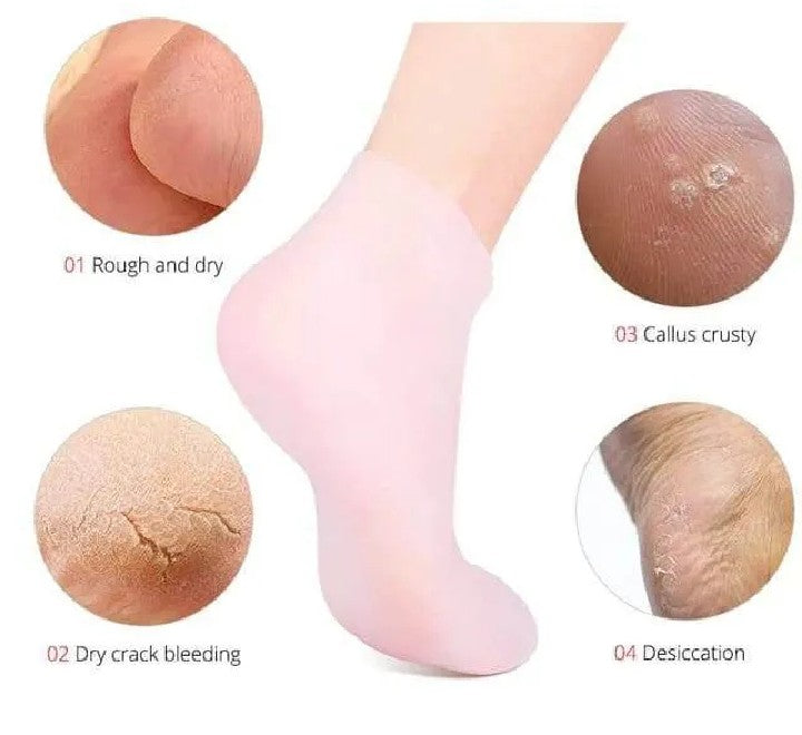 Moisturizing Silicone Gel Heel Socks for Soft, Smooth & Rejuvenated Feet